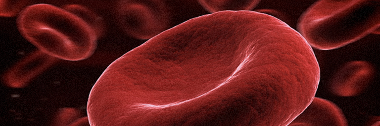 Anemia: What’s Really Going On and Why We Should Think Twice About Iron Supplements anemia